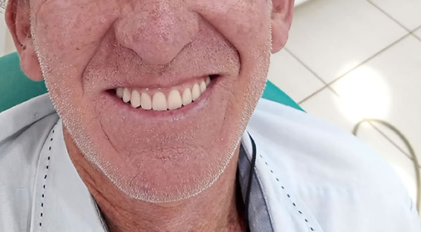 Em 2021 foram entregues 164 próteses dentarias para paciente de Campo Erê