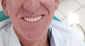 Em 2021 foram entregues 164 próteses dentarias para paciente de Campo Erê