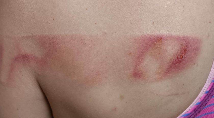 Homem é detido por lesão corporal e violência doméstica após agredir mulher