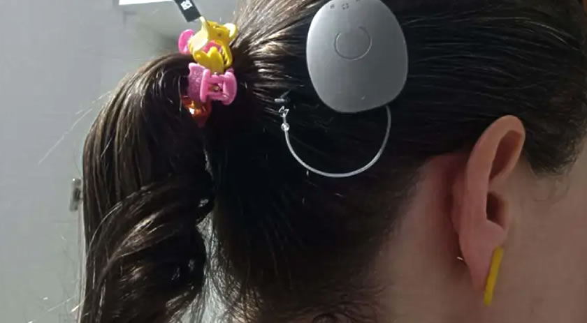 Estado lidera ranking nacional de implantes cocleares e se destaca em saúde auditiva