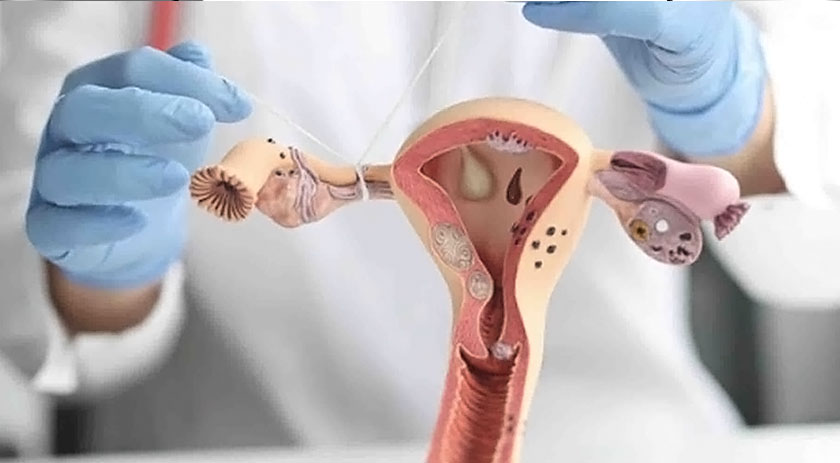 Senado aprova projeto que facilita acesso à laqueadura