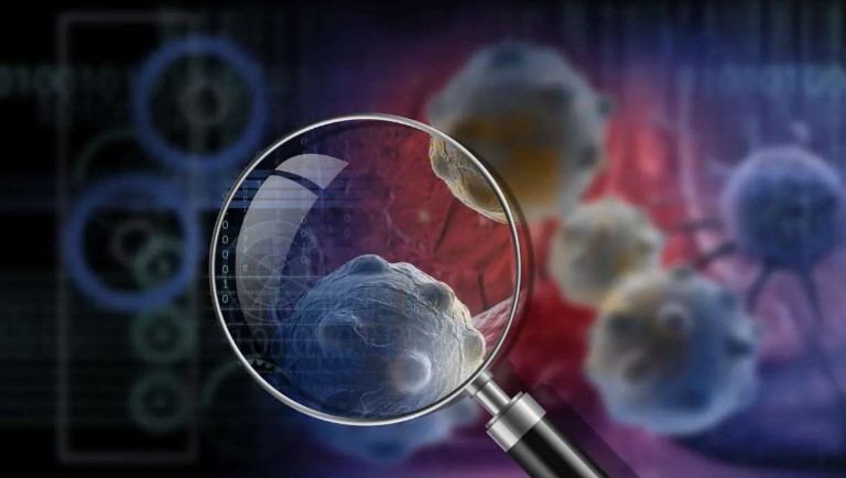 Estudo explica por que alguns tumores de mama resistem ao tratamento