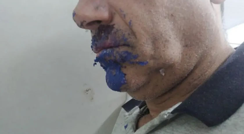 Paranaense é preso todo lambuzado e assume vício inusitado