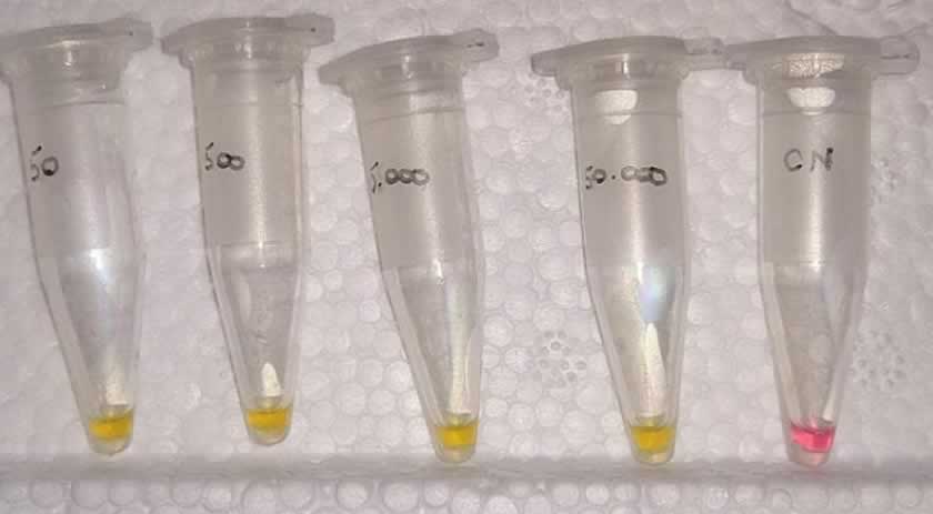 Teste para Covid mais barato e rápido do que o PCR é desenvolvido em SC