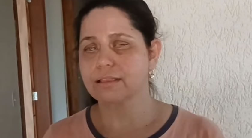 Moradora de Francisco Beltrão busca ajuda para realizar cirurgia ocular de R$ 50 mil