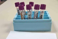 Fevereiro Laranja alerta para leucemia e reforça importância do diagnóstico precoce