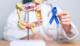 Mortes por câncer colorretal devem triplicar no Brasil até 2030