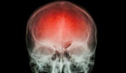 A cada 40 segundos, alguém sofre um AVC. Saber como reagir pode fazer a diferença