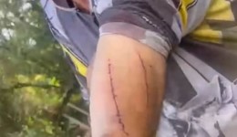 Agricultor de 76 anos sobrevive após lutar com onça-parda no Paraná