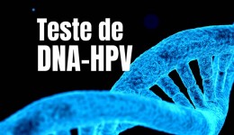 Teste de DNA-HPV será ampliado no Paraná com 300 mil kits distribuídos pelo SUS