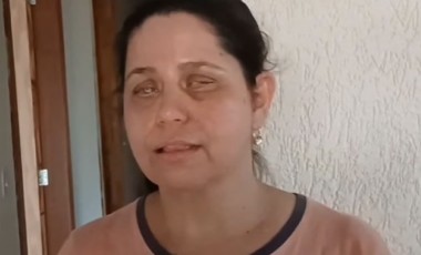 Moradora de Francisco Beltrão busca ajuda para realizar cirurgia ocular de R$ 50 mil
