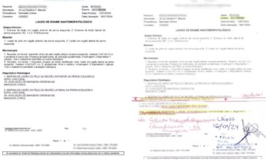 Médica é condenada a mais de 11 anos por falsos diagnósticos de câncer