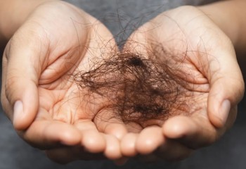 SUS inclui tratamento de câncer sem queda de cabelo que custa R$ 27 mil a sessão no particular