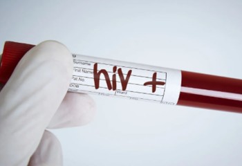 Homem é condenado a pagar R$ 60 mil após transmitir HIV à ex-companheira