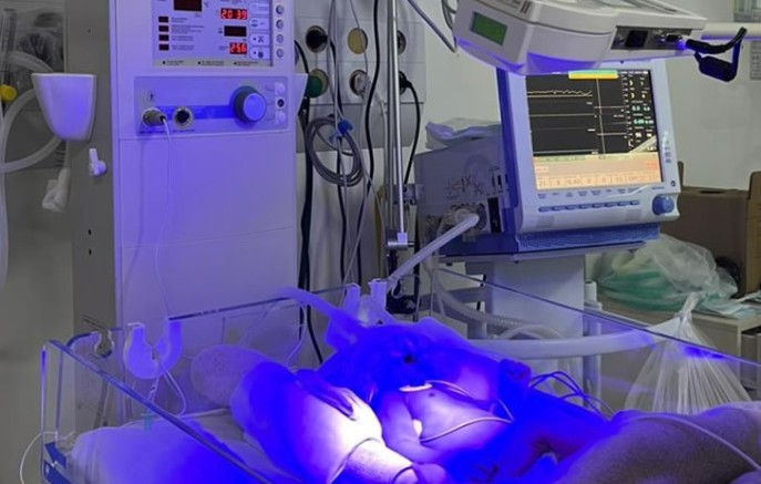 Francisco Beltrão lidera projeto pioneiro que protege cérebros de recém-nascidos no Paraná
