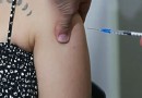 Anvisa indica vacina contra o HPV para prevenir mais tipos de câncer