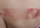 Homem é detido por lesão corporal e violência doméstica após agredir mulher