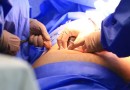 Cinco estados podem zerar fila de cirurgias no SUS