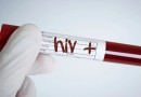 Homem é condenado a pagar R$ 60 mil após transmitir HIV à ex-companheira