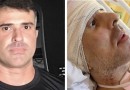 Policial civil baleado durante operação aérea no Rio não resiste aos ferimentos