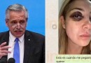 Ex-primeira-dama argentina diz a tribunal que foi forçada por Alberto Fernández a fazer aborto