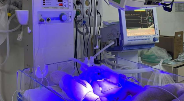 Hospital Regional inicia testes da UTI Neonatal Neurológica, pioneira na rede