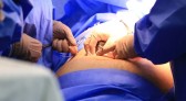 Cinco estados podem zerar fila de cirurgias no SUS