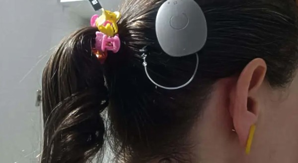 Estado lidera ranking nacional de implantes cocleares e se destaca em saúde auditiva