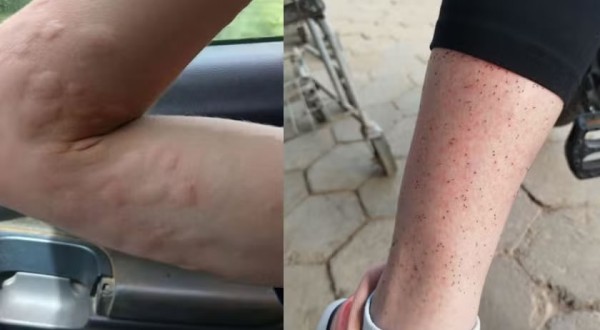 Moradores usam casaco e luvas em calor de 30°C para se proteger de infestação de mosquito em SC: 'Avançam no rosto da gente'