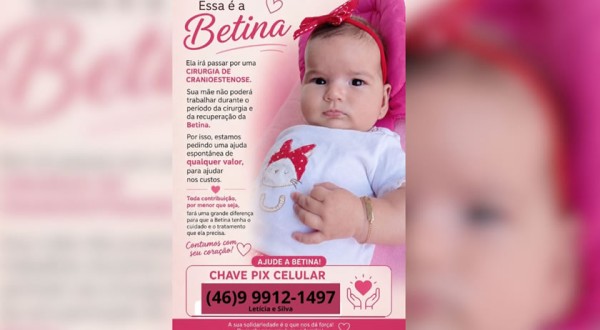 Família faz campanha para ajudar Betina em cirurgia de cranioestenose