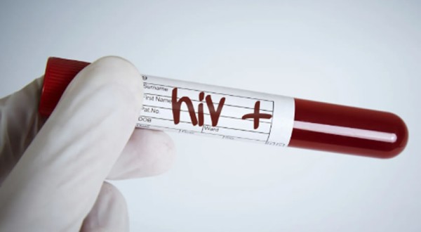 Homem é condenado a pagar R$ 60 mil após transmitir HIV à ex-companheira