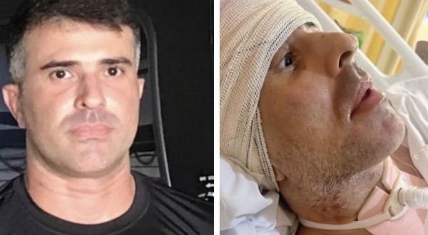 Policial civil baleado durante operação aérea no Rio não resiste aos ferimentos