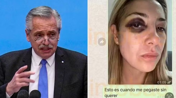 Ex-primeira-dama argentina diz a tribunal que foi forçada por Alberto Fernández a fazer aborto